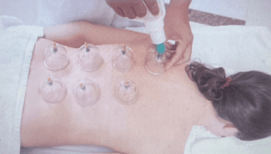 Image for Biomagnetic Cupping